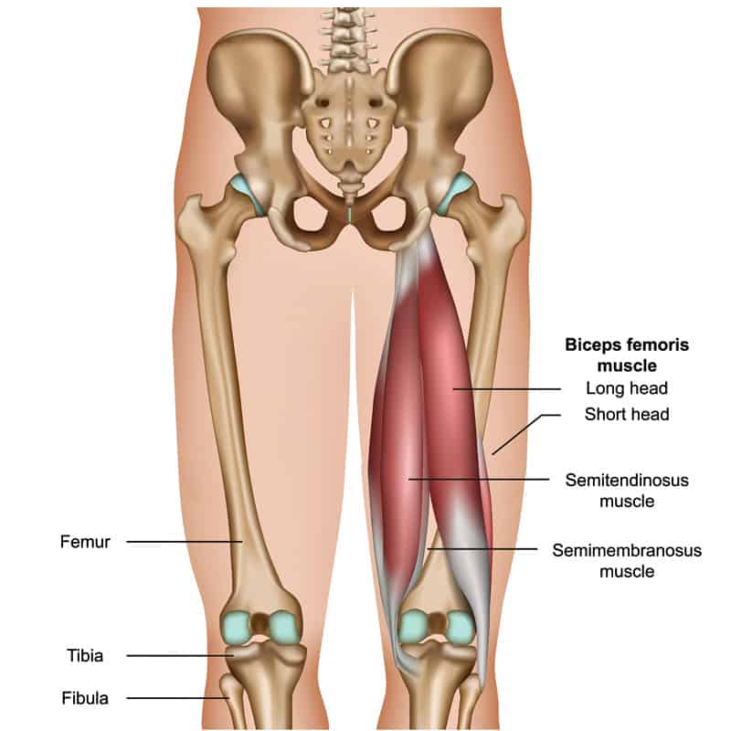 Chronic Hamstring Injuries When Sprinting: How To Stay Fit